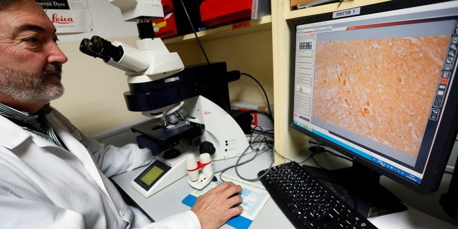 Svetski dan borbe protiv multiple skleroze