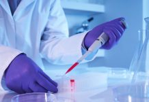 У Србији у последња 24 часа 169 људи заражено коронавирусом , још 3 особе преминуло, а 52 пацијента су на респираторима