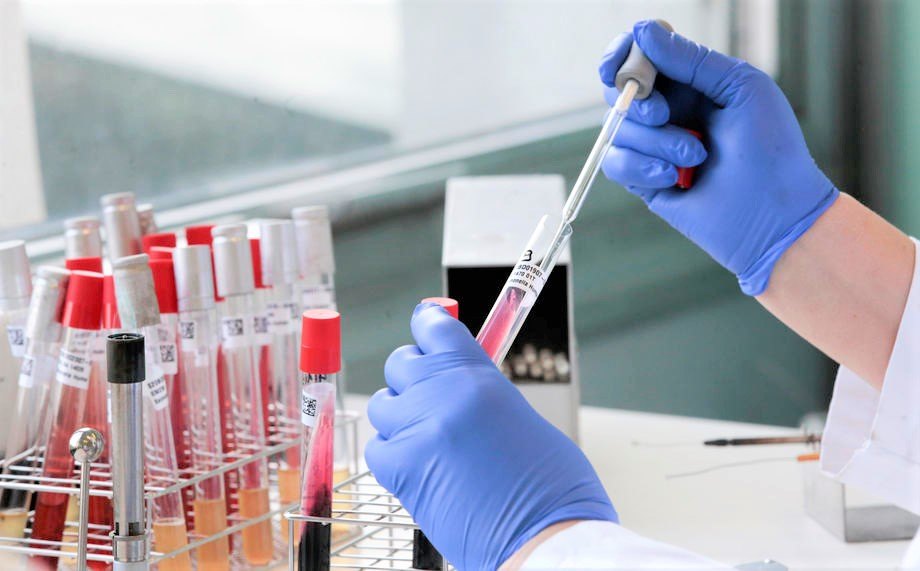 Sciensano Scientific research and analyse center