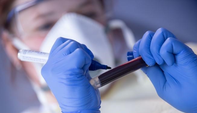 Ковид Тестирање