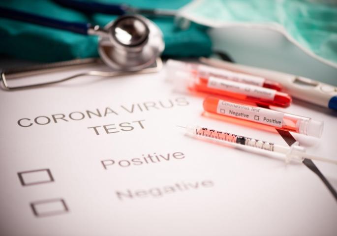 Ковид 19 Србија 02