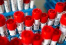 На Косову и Метохији од ковида 19. за 24 сата преминуле још 24 особе, а још 424 људи оболело Вртићи се затварају, настава одлаже. Полицијски час остаје на снази.